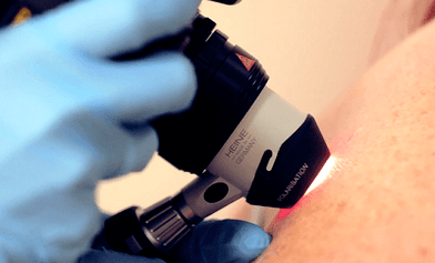 Metody diagnostyczne dla brodawki podeszwowej