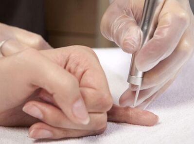 Prowadzenie terapii laserowej